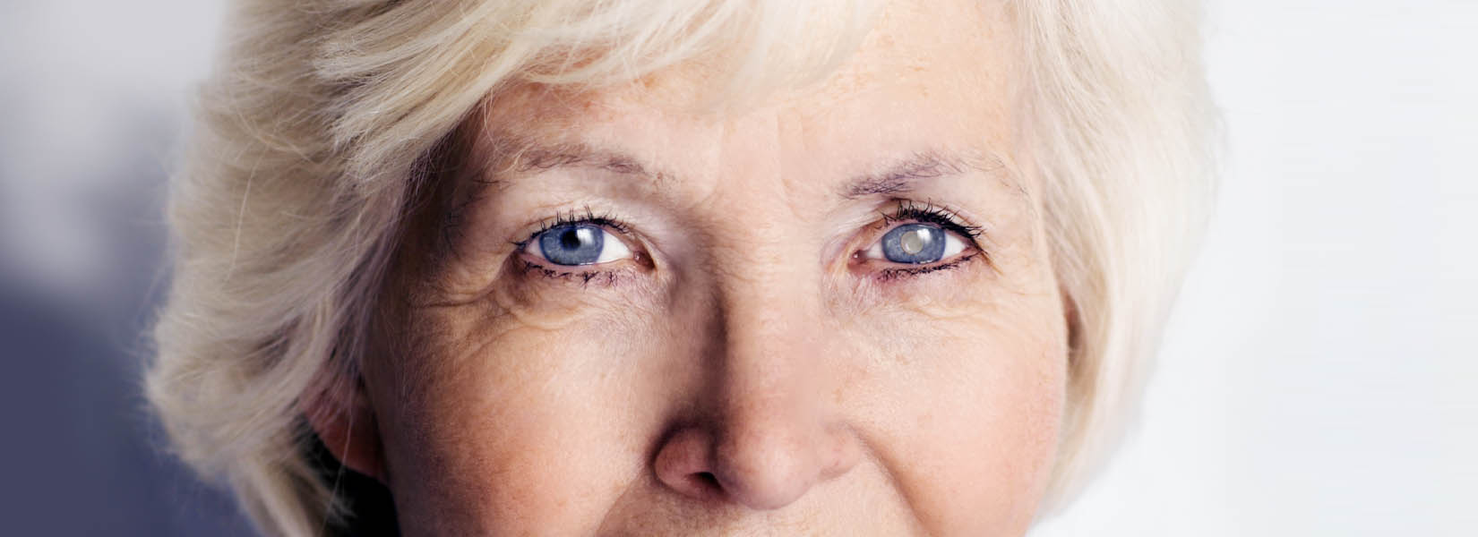Cataract Surgery in Sable Ridge
